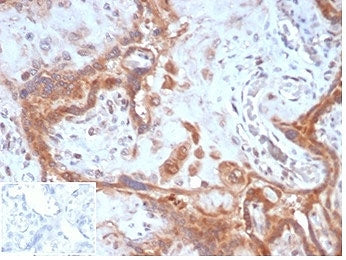 IHC staining of FFPE human placental tissue with Fibroblast Activation Protein Alpha antibody (clone
