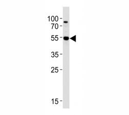 AKT3 Antibody