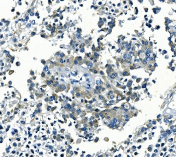 KCNJ8 Antibody
