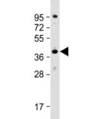 DNAJB4 Antibody