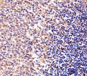 Immunohistochemical analysis of paraffin-embedded mouse spleen section using Cyclin B1 antibody. Ab 