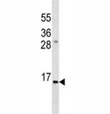 Insulin Antibody