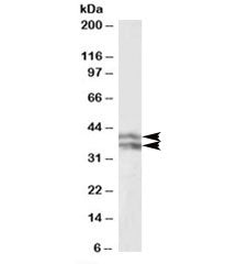 HP Antibody (Haptoglobin beta chain)