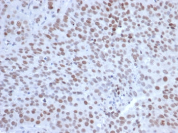 EZH2 Antibody