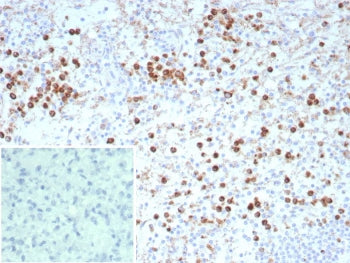 IHC staining of FFPE human spleen tissue with recombinant LAMP-3 antibody (clone rLAMP3/9131). Inset