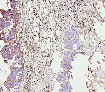 IRAK1 Antibody