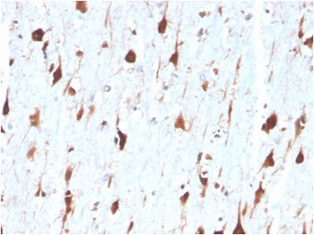 IHC staining of FFPE human brain tissue with Carbonic Anhydrase VIII antibody (clone CA8/6572). HIER