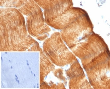 IHC staining of FFPE human skeletal muscle with recombinant Sarcomeric Alpha Actinin antibody (clone