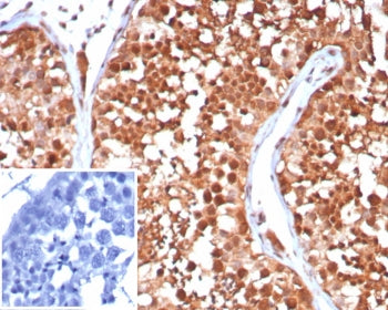 IHC staining of FFPE human testis tissue with HSP70-1A antibody (clone HSPA1A/7932). Inset: PBS used