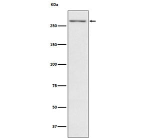 TG Antibody / Thyroglobulin