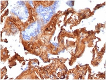 IHC staining of FFPE human lung tissue with Fibronectin 1 antibody (clone FN1/3569). HIER: boil tiss