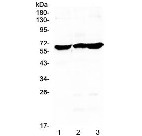 Glycerol kinase Antibody / GK