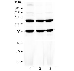 VEGF Receptor 3 Antibody / VEGFR3