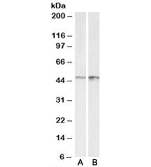 Western blot testing of A431 [A] and HeLa [B] lysates with E2F4 antibody at 0.3ug/ml. Expected molec