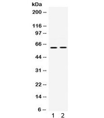 Western blot testing of 1) rat brain and 2) mouse brain lysate with PAK3 antibody. Expected/observed