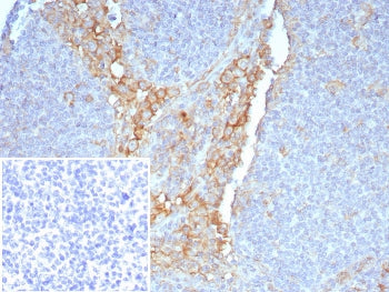 FCGR1A Antibody / CD64