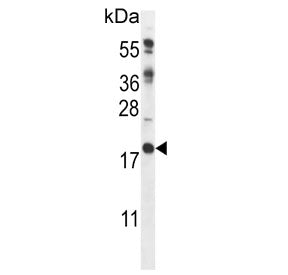 Calcipressin-2 Antibody / RCAN2 / DSCR1L1