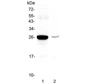 Mbl2 Antibody / Mannose-binding lectin 2