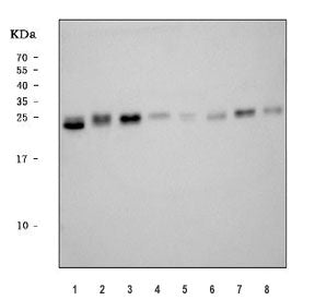 Western blot testing of 1) human HepG2, 2) human T-47D, 3) human HeLa, 4) human SH-SY5Y, 5) rat live