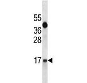 IGF1 Antibody