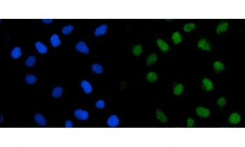Immunofluorescent staining of FFPE human HeLa cells with TRMT1 antibody (green) and DAPI nuclear sta