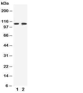 Western blot testing of EphB3 antibody and Lane 1: HeLa; 2: A549 cell lysate