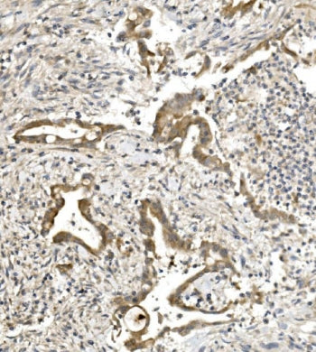Nectin 1 Antibody / PVRL1