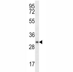 Myogenin Antibody