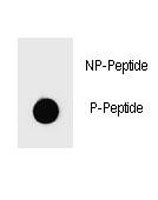 PARP Antibody (phospho-S864)