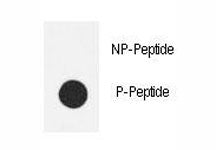 Phospho-eNos Antibody (pS1177)