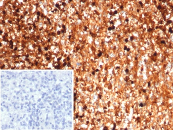 S100A9 Antibody / MRP14 / Calgranulin B / Calprotectin L1H