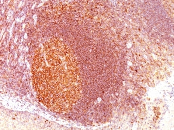 IHC: Formalin-fixed, paraffin-embedded human tonsil stained with MALT1 antibody (clone SPM578).
