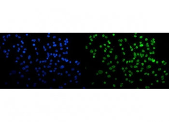 CBX5 Antibody / HP1A / HP1 alpha