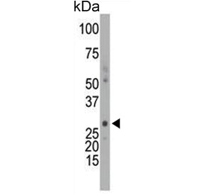 Western blot testing of mouse intestine tissue lysate with Deoxycytidine kinase antibody. Predicted 
