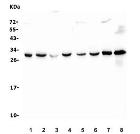 Western blot testing of 1) human HeLa, 2) human A549, 3) monkey COS-7, 4) human Raji, 5) human Caco-