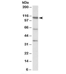 Western blot testing of human testis lysate with CP110 antibody at 1ug/ml. The expected ~110 kDa ban