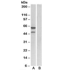 E2F3 Antibody
