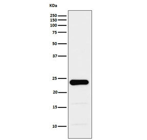GST pi Antibody / GSTP1