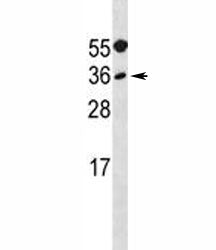 MYF5 Antibody