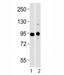 Western blot testing of Uhrf1 antibody at 1:1000 dilution + 1) mouse heart and 2) mouse thymus lysat