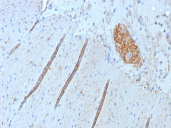 IHC staining of FFPE human colon tissue with recombinant CD56 antibody (clone NCAM1/8392R). HIER: bo