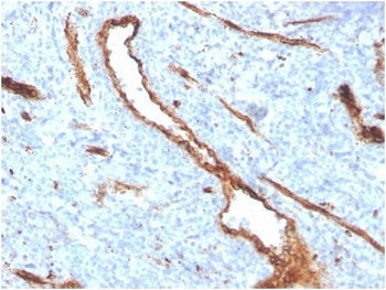IHC staining of FFPE human bone marrow with recombinant von Willebrand Factor antibody (clone VWF/43