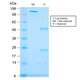 SDS-PAGE analysis of purified, BSA-free recombinant CLIP antibody (clone rCLIP/1418) as confirmation