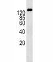 P-Glycoprotein (ABCB1) Antibody
