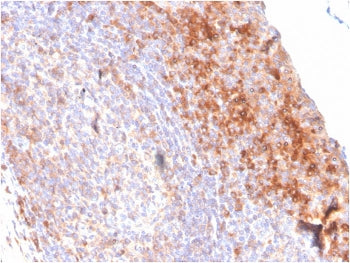 IHC staining of FFPE human tonsil with CD80 antibody (clone C80/3544). HIER: boil tissue sections in