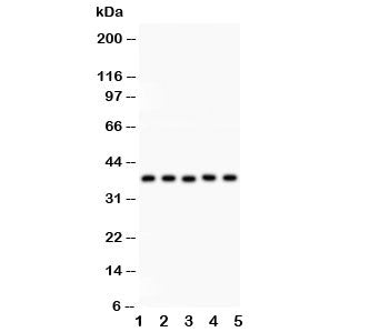 KLF6 Antibody