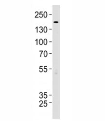 TSC2 Antibody