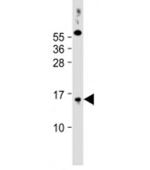 Western blot testing of human PC-3 cell lysate with SYNJBP antibody at 1:2000. Predicted molecular w
