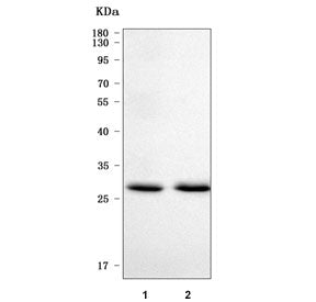 PPP1R3B Antibody / Protein phosphatase 1 regulatory subunit 3B