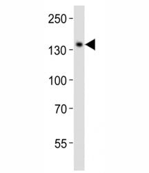 Western blot analysis of lysate from CEM cell line using SALL4 antibody diluted at 1:1000. Isoform A